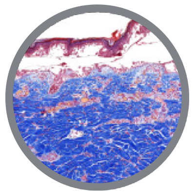 Earlier epidermal separation