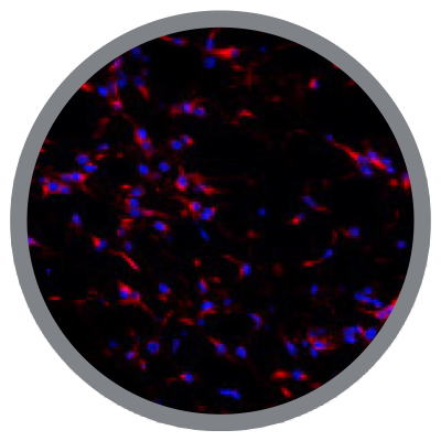 Improved progression to inflammation resolution