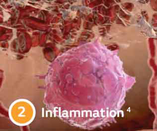 Inflammation