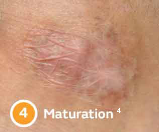 Maturation