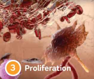 Proliferation