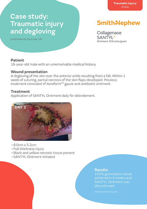 Traumatic injury and degloving