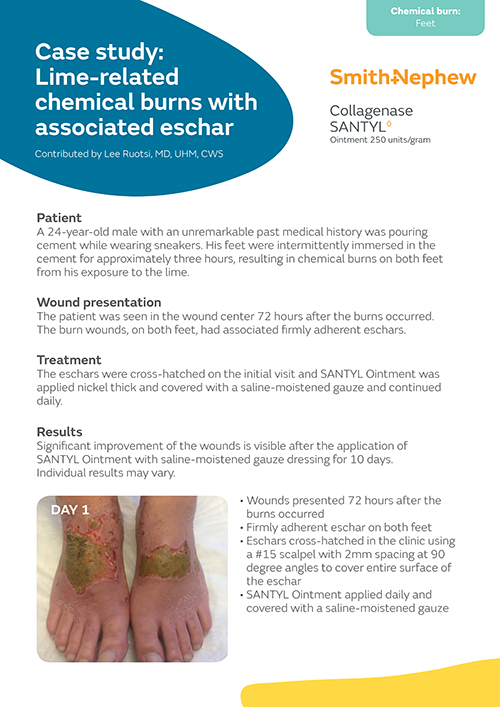 Lime-related chemical burns with associated eschar