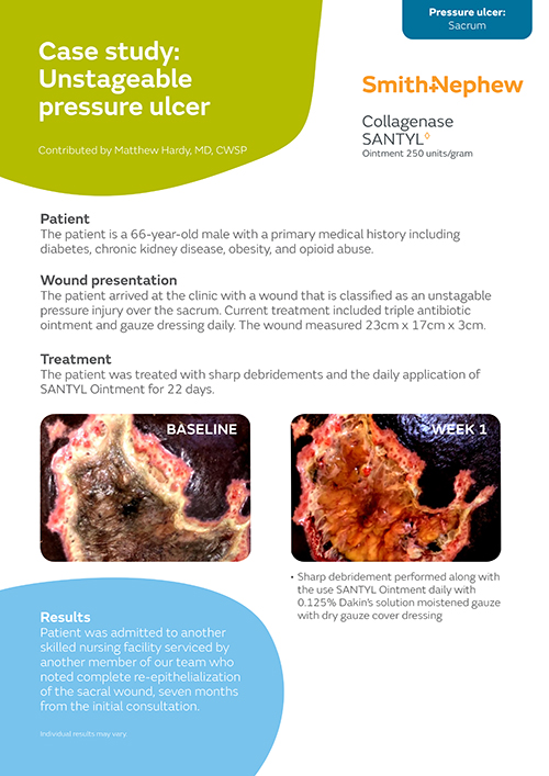 Unstageable pressure ulcer