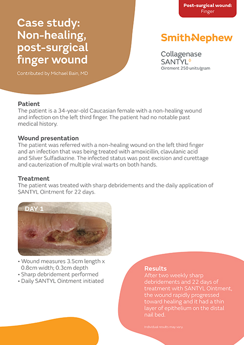 Non-healing, post-surgical finger wound