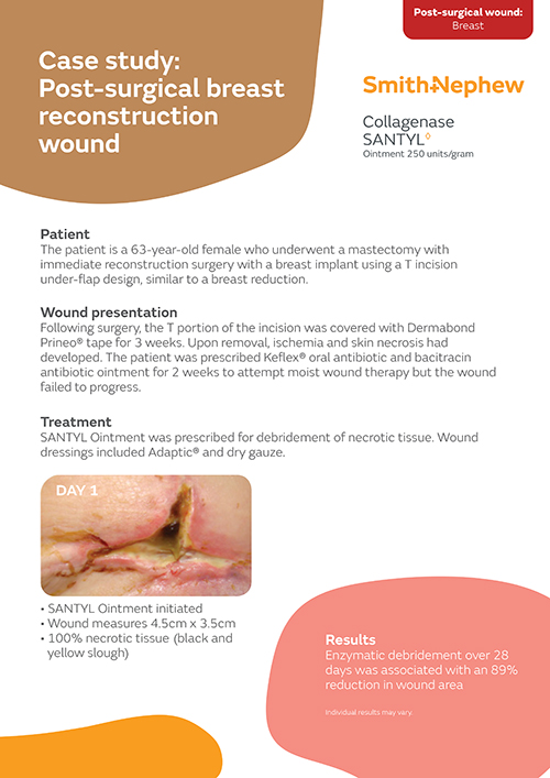 Post-surgical breast reconstruction wound
